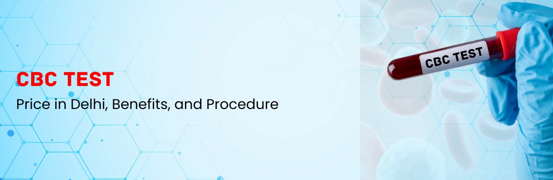 CBC (Complete Blood Count) Test Price in Delhi, Benefits, and Procedure